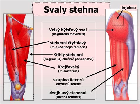 Bolest zadní strany stehna